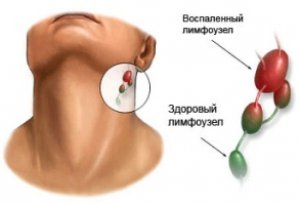 Uzi fej és a nyak szervek típusok, jelzések, magatartás, az eredmények
