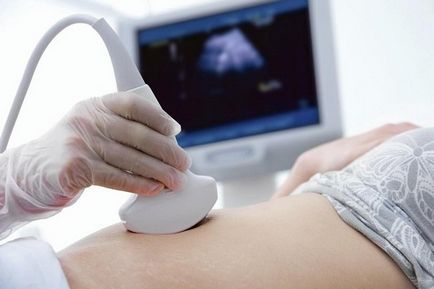 Ultrahang a terhesség korai szakaszában - amikor kell csinálni, és nem rossz
