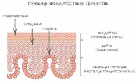 Vegyi peeling visszacsatolási hatások, a típusú arc hámlani kezd, ellenjavallatok