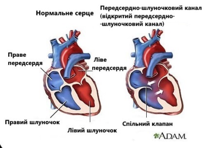 7 tünetei szív zajok, akkor tudatában kell lennie