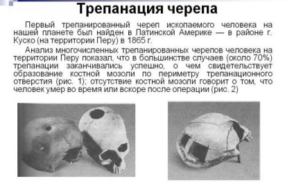 A hipofízis adenoma - tumor tünetek a nők és a kezelés hatását (adenoma) A hipofízis adenoma - tumor tünetek a nők és a kezelés hatásainak