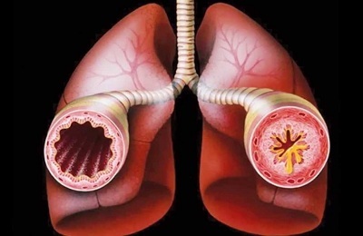 Asztma hagyományos kezelések otthon