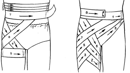 Mi a teendő, ha nyúlik a csípő hátizmok és az elülső felület