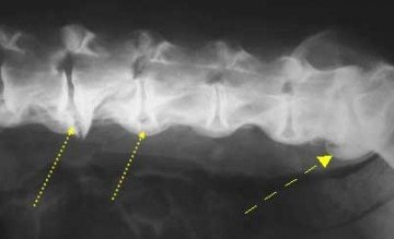 Diagnosztizálására és kezelésére osteophytes