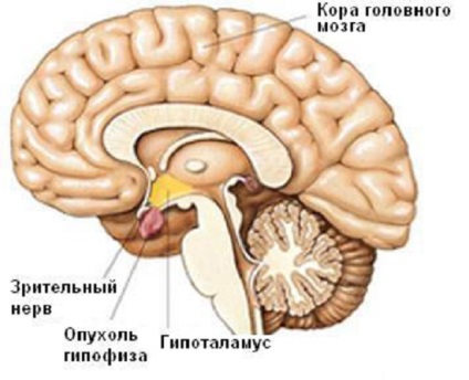 Agyalapi mirigy - egy fontos agyi vas és szerepe az emberi életben