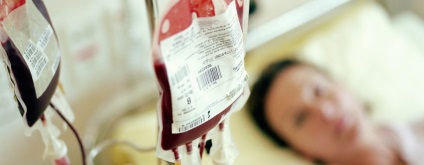 Hipotóniás vérzés a korai szülést követő időszakban