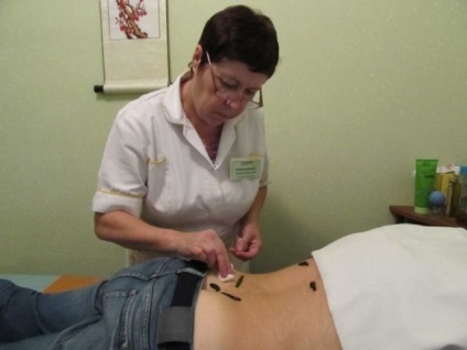 Hirudotherapy pióca terápia magas vérnyomás, egy pont-beállító áramkörhöz