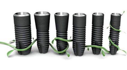 Az implantátumok astra tech (Astra Tech) implantátumok Svédország (implantátumok) Az implantátumok astra tech (Astra Tech) implantátumok Svéd