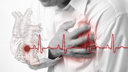 Szívinfarktus cukorbetegség jellemzői, a tünetek, a kezelés (cukorbetegség) Szívinfarktus diabetes mellitusban funkciók, a tünetek, a kezelés