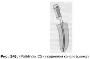 Eszközök a folyosón a gyökérkezelés (hossza a dolgozó rész) Eszközök a folyosón a gyökérkezelés