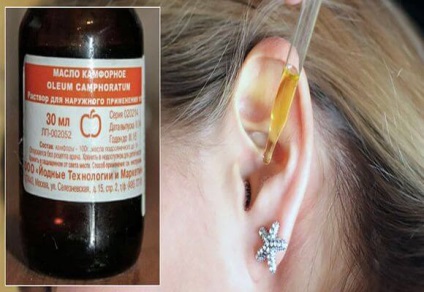 Kámfor olajat otitis alkalmazás (olaj) Kámforolaj alkalmazás otitis