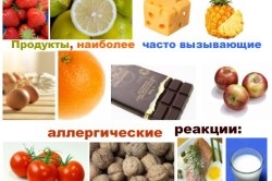 Szúró allergiában (kb allergiák) Szúró allergiától