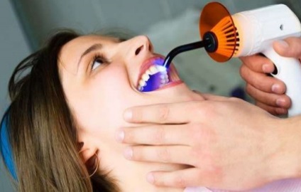 A kezelés fogszuvasodás nélkül drill - lézer, ózon és ikon, fogak