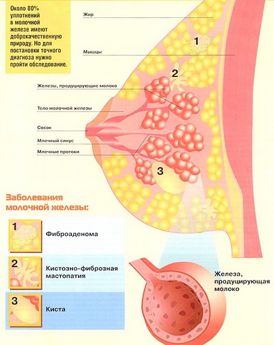 Mell - okai tőgygyulladás - mastitis tünetek