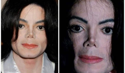 Maykl Dzhekson előtt és után plasztikai sebészet fotók és videó