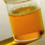 Vizelet színe sör okok és megelőzés (ok) Vizelet színe sör okai és megelőzése