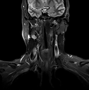 MRI a lágy szövetek, a nyak, hogy az MRI a lágy szövetek, a nyak mutatja a lágy szövetek, az arc, mri puha ár