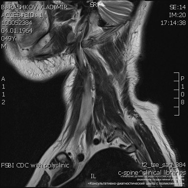Jellemzői MRI a lágy szövetek, a nyak