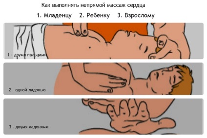 Mérgezés kipufogógáz tünetek, elsősegély, kezelése (mérgezés) Mérgezés kipufogógáz tünetek, elsősegély, kezelés