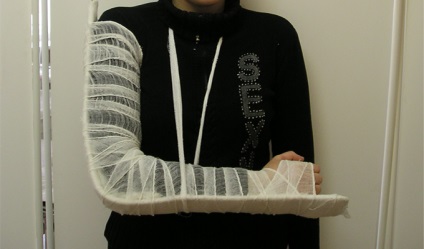 Törések a tuberkulózis a humerus (okait és tüneteit törések a nagy és a kis tubercles a humerus elsősegély kezelés) Törések a tubercle a humerus