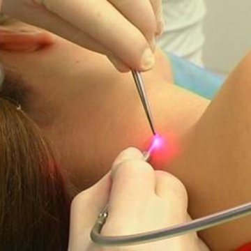 Miért kapok mol a test egy felnőtt (test) Miért kapok mol a test egy felnőtt
