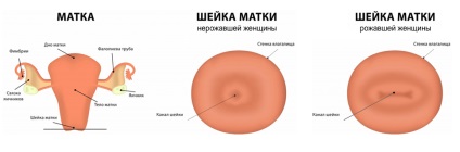 A méhnyak (nyak) méhnyak