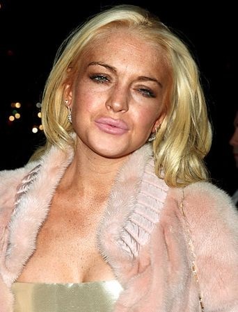 Shock! Mi történt az arcát Lindsay Lohan (Kép) (show business) Shock! Mi történt az arcát Lindsay Lohan (fotó)