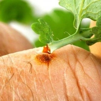 Juice vérfű (Chelidonium) leve vérfű