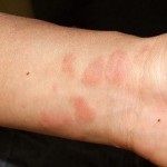 Mosóporok az allergiás (allergia detergens) Mosóporok allergiásoknak