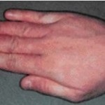 Mosóporok Allergy (detergens) Mosóporok allergiásoknak