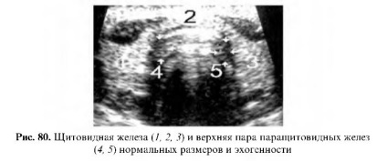 Ultrahang vizsgálat a mellékpajzsmirigy