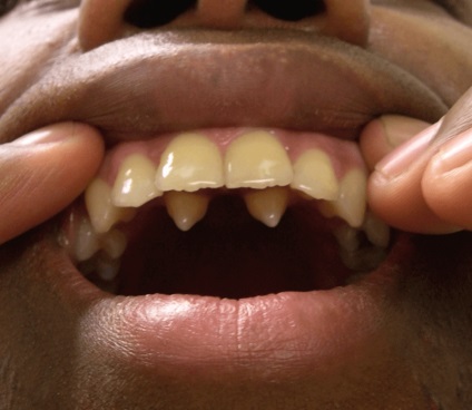 9 meglepő tényt az emberi fogak