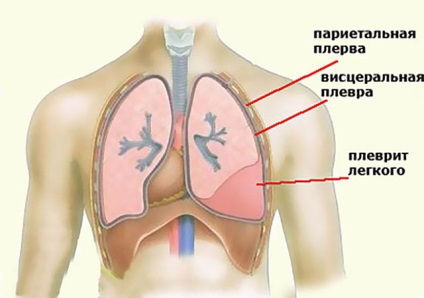 Fájdalom a szív inhalálás során - okai, módszerek válasz a problémára (szív) Fájdalom a szív inhalálás során - okozza, módszerek reagál a probléma
