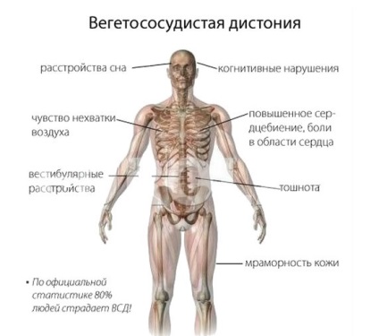 Mi különbözik a VSD hypertonia hipertóniás típusú megemelt nyomáson (hipertónia eltér a VSD a hipertóniás típus) Mi eltér a VSD magas vérnyomás hipertóniás típusú nyomásfokozó