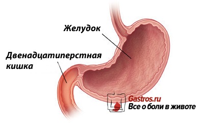 Duodenitis tünetek, a kezelés és típusok