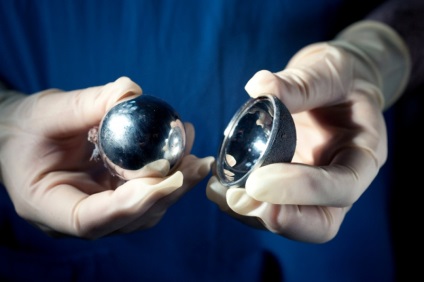 Hip arthroplasty Németország (Németország) Csípőprotézis Németországban