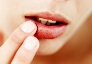 Herpes az ajkak az okok, tünetek, fotó, gyors kezelés gyógyszerek