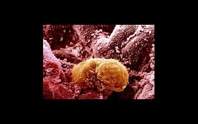 Embrióbeültetésben a méhben, mivel akkor jelentkezik, ha a beültetés után IVF (ha van) Embrióbeültetésben a méhben, valamint akkor, amikor van implantáció után IVF