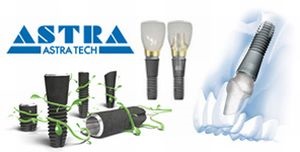 Implantátumok astra tech (Astra Tech) típusú, a technológia, valódi előnyöket, az ár