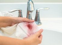 Hogyan mossa a vért az ágy fehér lenvászon (vér) Hogyan mossa le a vért a ágynemű fehér