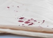 Hogyan mossa le a vért a ágynemű fehér