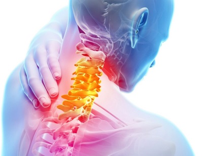 Radicularis szindróma, nyaki gerinc a tünetek, a kezelés