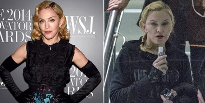 Beauty rettenetes erő Madonna készült plasztikai
