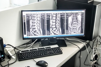 CT a gerinc - a modern diagnosztikai eljárás