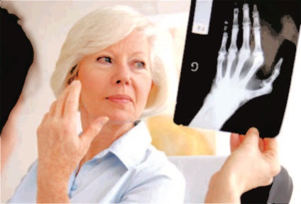 Az oszteoartritisz kezelése arra a kis ízületek a kéz és a megelőzésére betegség (osteoarthritis) Az osteoarthritis kezelésére a kis ízületek a kéz és a betegségek megelőzése