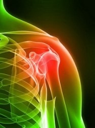 Kezelése glenohumeral (váll) periarthritis (periartritisz) Kezelése glenohumeral (váll) periarthritis
