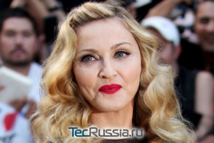 Madonna - fotók előtt és után plasztikai sebészet