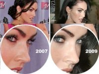 Megan Fox előtt és után műanyagból (utána) Megan fox előtt és után plasztikai