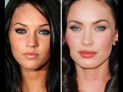 Megan fox előtt és után műanyag (fotó)