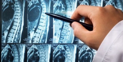 MRI a lágy szövetek, a nyak, amely megmutatja, hogyan mennek a dolgok a nyaki gerinc